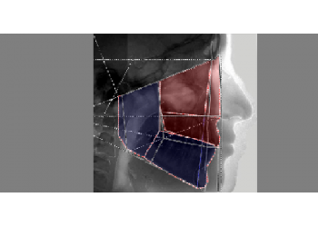 Logiciel DELAIRE CEPHALOMETRIE Blued
