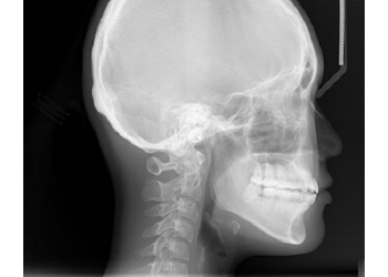 Logiciel CEPHALOEXPERT Blued