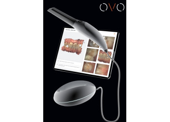 Scanner intra oral OVO